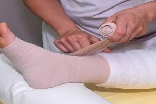 Lymphedema management